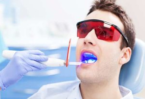 Procedures for Laser Dentistry Treatments